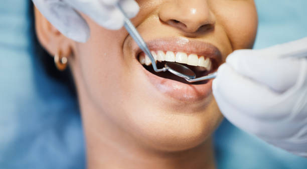 Best Pediatric Emergency Dentist in Great Falls, SC